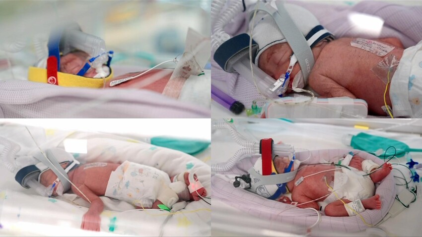 The identical quadruplet girls are receiving specialist care in the Royal Brisbane and Women’s Hospital neonatal intensive care unit. Credit: RBWH